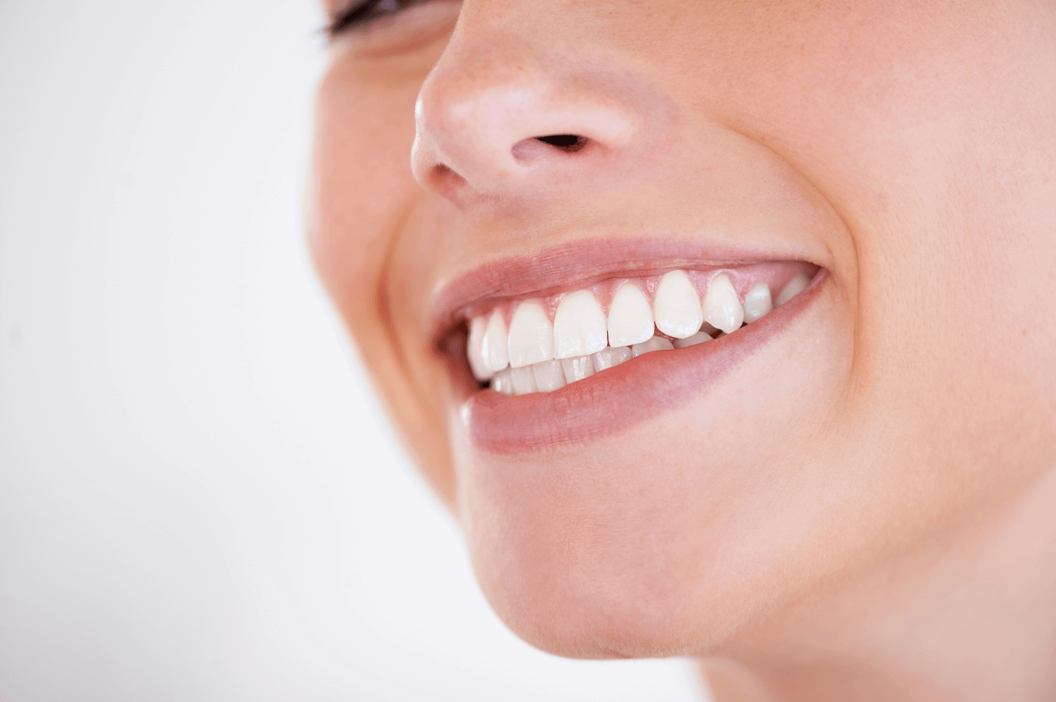 woman with straight teeth after getting Invisalign at 19 wimpole st dental practice in London