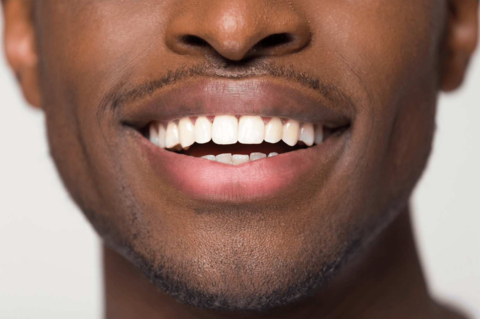 Man with composite bonding from our dentist in marylebone